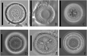 Light micrographs of diatom Cyclotella sensu lato taxa. Six taxa are: (A) Discostella stelligera; (B) Discostella pseudostelligera; (C) Lindavia comensis; (D) Lindavia delicatula; (E) Lindavia ocellata; (F) Lindavia bodanica. Scale bars to left of each taxon indicate 10 μm. (Source: Kireta and Saros, 2019)