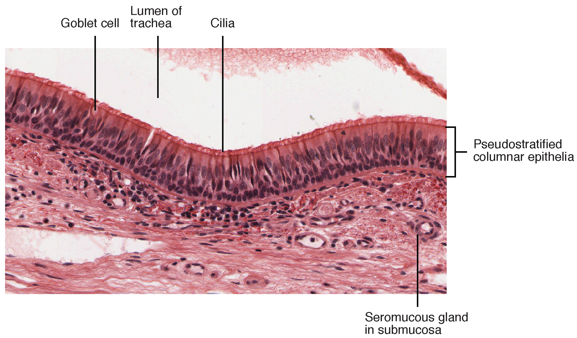 Pseudostratified Ciliated Columnar Epithelium. Image description available.