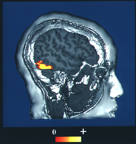An f M R I scan of a human head with energy consumption in the vision center shown by a bright spot. This brightness indicates the energy consumption.