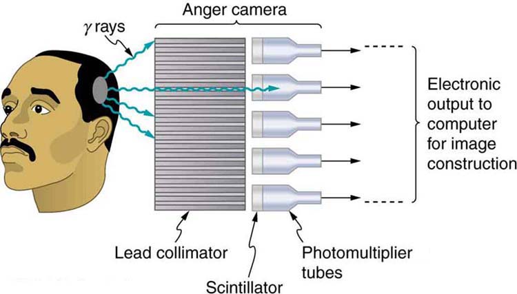 The image shows the head of a man scanned by an Anger camera. The camera consists of a lead collimator and array of detectors. Gamma rays emerging from the man’s head pass through the lead collimator and produce light flashes in the scintillators. The photomultiplier tubes convert the light output to electrical signals for computer image generation.
