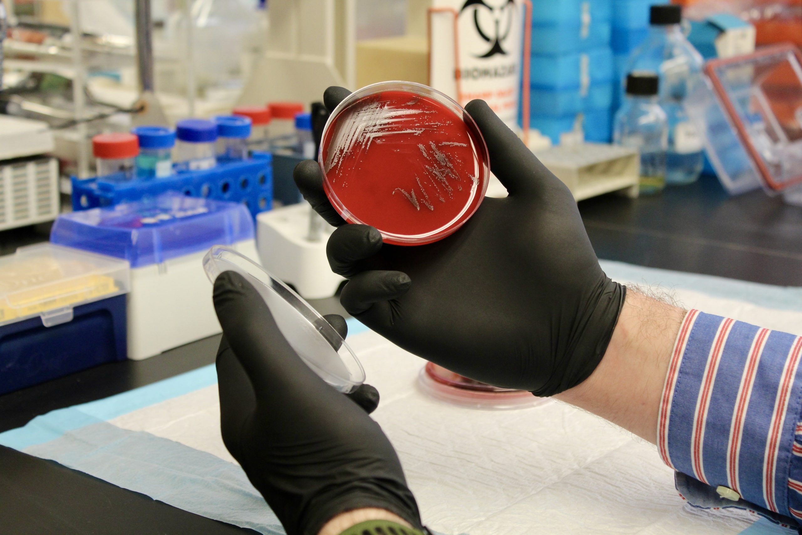 Caleb Ardizzone, PhD, a Postdoctoral Researcher in the Division of Infectious Diseases holds a Petri dish.