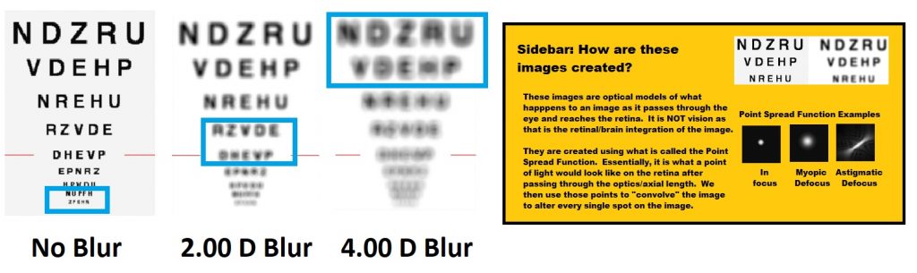 Chapter 1: Visual Acuity in Refraction and Refractive Error – Clinical ...